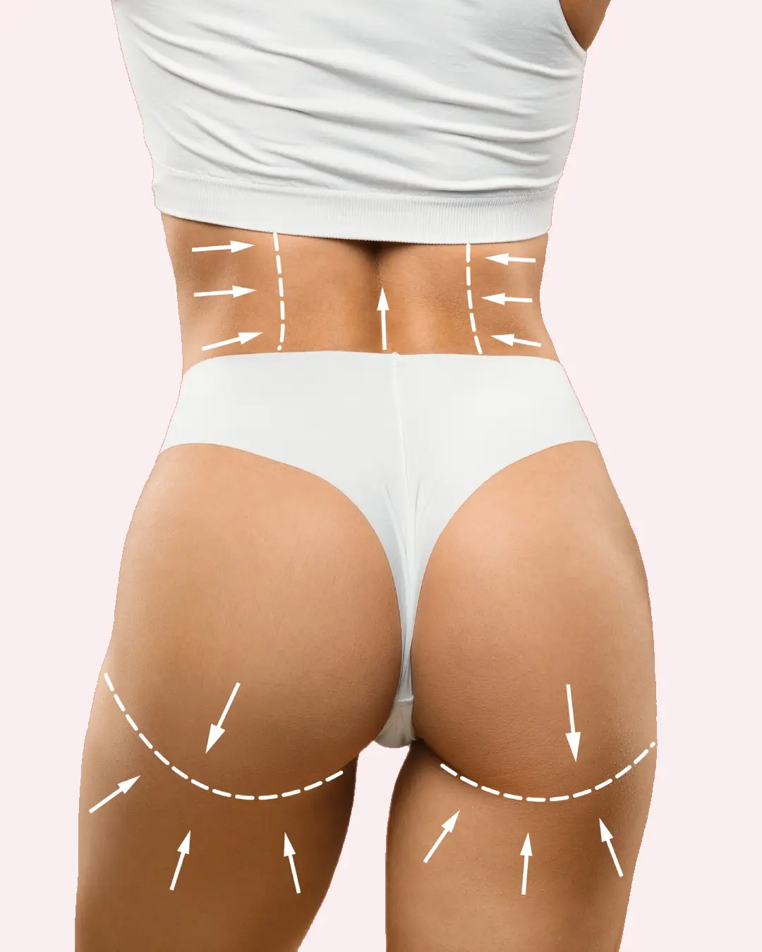 harmonizacao-de-gluteos-em-brasilia